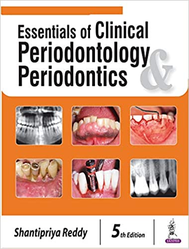 Essentials of Clinical Periodontology and Periodontics 5th Edition PDF Essentials of Clinical Periodontology and Periodontics 5th Edition PDF