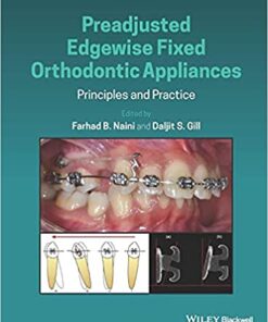 Preadjusted Edgewise Fixed Orthodontic Appliances: Principles and Practice 1st Edition PDF