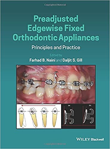 Preadjusted Edgewise Fixed Orthodontic Appliances: Principles and Practice 1st Edition PDF Preadjusted Edgewise Fixed Orthodontic Appliances: Principles and Practice 1st Edition PDF