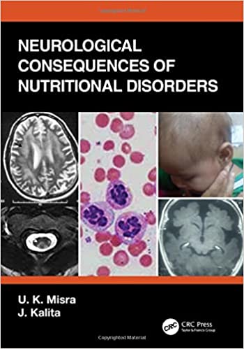 Neurological Consequences of Nutritional Disorders 1st Edition PDF Neurological Consequences of Nutritional Disorders 1st Edition PDF