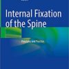Internal Fixation of the Spine: Principles and Practice 1st ed. 2021 Edition PDF Internal Fixation of the Spine: Principles and Practice 1st ed. 2021 Edition PDF