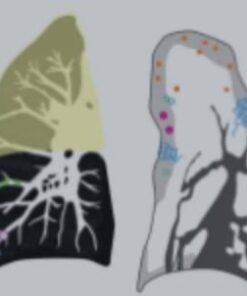 Imaging Mastery Series: Consolidation and Ground Glass 2021
