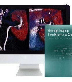 ARRS Oncologic Imaging: From Diagnosis to Cure 2016