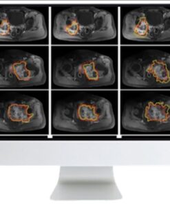 Crossroads of Computational Science and Musculoskeletal Imaging: Where Machine Magic Can Aid Radiologists 2021