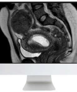 ARRS Abdominal MRI: Practical Applications and Advanced Imaging Techniques 2021