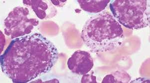 Hematopathology 2021