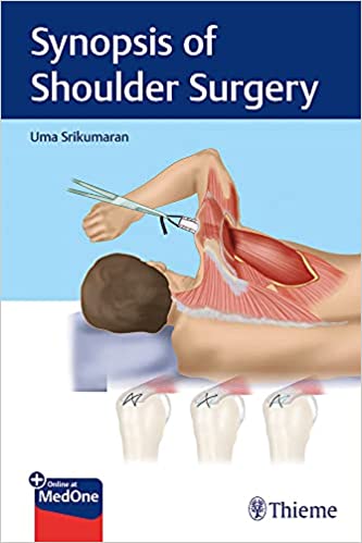 Synopsis of Shoulder Surgery 1st Edition PDF Synopsis of Shoulder Surgery 1st Edition PDF