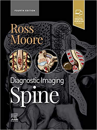 Diagnostic Imaging: Spine, 4th Edition (Original PDF) Diagnostic Imaging: Spine, 4th Edition (Original PDF)