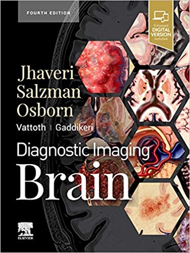Diagnostic Imaging: Brain 4th Edition PDF Original & VIDEO Diagnostic Imaging: Brain 4th Edition PDF Original & VIDEO