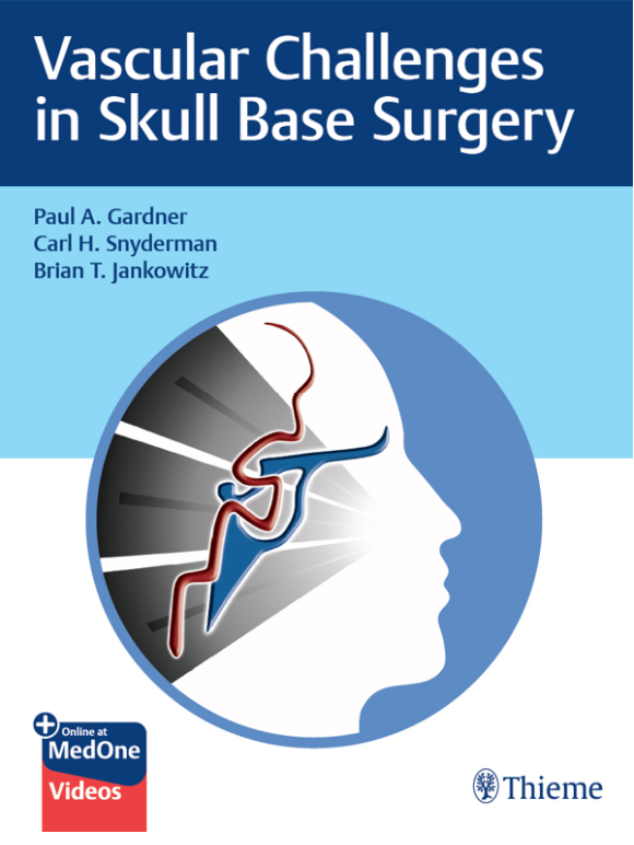 Video Vascular Challenges in Skull Base Surgery 1st Edition PDF Original & Video Video Vascular Challenges in Skull Base Surgery 1st Edition PDF Original & Video