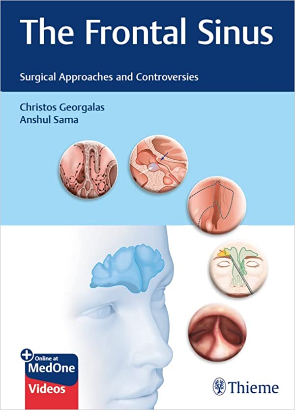 The Frontal Sinus: Surgical Approaches and Controversies 1st Edition PDF & VIDEO The Frontal Sinus: Surgical Approaches and Controversies 1st Edition PDF & VIDEO