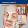Rhinoplasty: The Experts’ Reference 1st Edition PDF