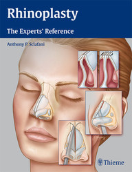 Rhinoplasty: The Experts’ Reference 1st Edition PDF