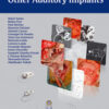 Surgery for Cochlear and Other Auditory Implants 1st Edition PDF Surgery for Cochlear and Other Auditory Implants 1st Edition PDF