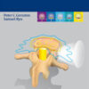Spine Radiosurgery 1st Edition PDF Spine Radiosurgery 1st Edition PDF