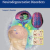 Imaging of Neurodegenerative Disorders 1st Edition PDF Imaging of Neurodegenerative Disorders 1st Edition PDF