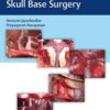 Atlas of 360 degrees Skull Base Surgery PDF Atlas of 360 degrees Skull Base Surgery PDF