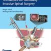 Video Essential Step-by-step Techniques for Minimally Invasive Spinal Surgery 1st Edition Video Essential Step-by-step Techniques for Minimally Invasive Spinal Surgery 1st Edition