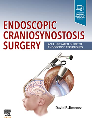 Endoscopic Craniosynostosis Surgery PDF Endoscopic Craniosynostosis Surgery PDF