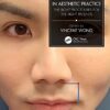Decision Making in Aesthetic Practice: The Right Procedures for the Right Patients 1st Edition PDF Decision Making in Aesthetic Practice: The Right Procedures for the Right Patients 1st Edition PDF
