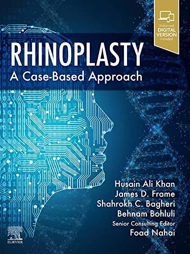 Rhinoplasty E-Book: a Case-based approach PDF & Video Rhinoplasty E-Book: a Case-based approach PDF & Video