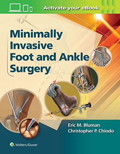 Minimally Invasive Foot & Ankle Surgery (Minimally Invasive Orthopaedic Surgery) First Edition PDF Minimally Invasive Foot & Ankle Surgery (Minimally Invasive Orthopaedic Surgery) First Edition PDF