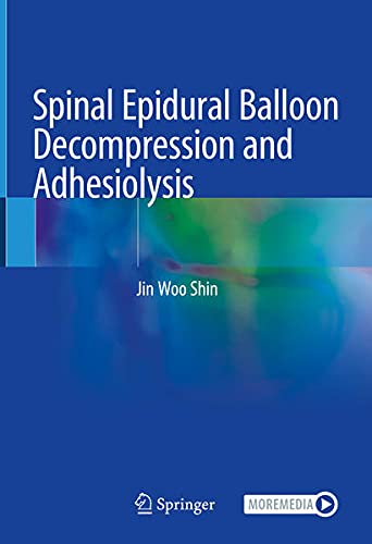 Spinal Epidural Balloon Decompression and Adhesiolysis 1st ed. 2021 Edition PDF Original Spinal Epidural Balloon Decompression and Adhesiolysis 1st ed. 2021 Edition PDF Original