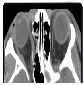 Imaging Victims of Violence Fists, Stabs, Bullets, and Blasts 2021 (CME VIDEOS) Imaging Victims of Violence Fists, Stabs, Bullets, and Blasts 2021 (CME VIDEOS)