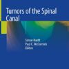 Tumors of the Spinal Canal 1st ed. 2021 Edition PDF Original Tumors of the Spinal Canal 1st ed. 2021 Edition PDF Original