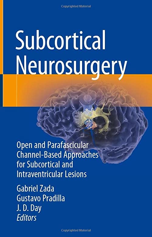 Subcortical Neurosurgery: Open and Parafascicular Channel-Based Approaches for Subcortical and Intraventricular Lesions 1st ed. 2022 Edition PDF Original
