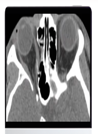 ARRS Imaging Victims of Violence: Fists, Stabs, Bullets, and Blasts 2021 (CME VIDEOS) ARRS Imaging Victims of Violence: Fists, Stabs, Bullets, and Blasts 2021 (CME VIDEOS)
