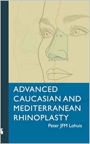 Advanced Caucasian and Mediterranean Rhinoplasty 1st Edition