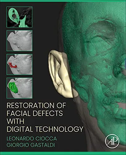 Restoration of Facial Defects with Digital Technology (Original PDF from Publisher) Restoration of Facial Defects with Digital Technology (Original PDF from Publisher)