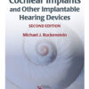 Cochlear Implants and Other Implantable Hearing Devices, 2nd Edition (Original PDF from Publisher) Cochlear Implants and Other Implantable Hearing Devices, 2nd Edition (Original PDF from Publisher)