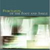 Fractures of the Foot and Ankle (Original PDF From Publisher) Fractures of the Foot and Ankle (Original PDF From Publisher)