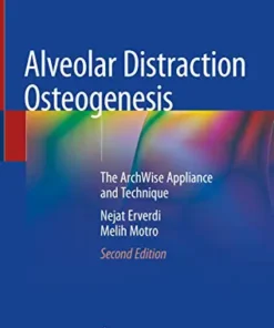 Alveolar Distraction Osteogenesis: The ArchWise Appliance and Technique, 2nd Edition (Original PDF from Publisher)