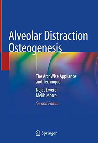 Alveolar Distraction Osteogenesis: The ArchWise Appliance and Technique, 2nd Edition (Original PDF from Publisher) Alveolar Distraction Osteogenesis: The ArchWise Appliance and Technique, 2nd Edition (Original PDF from Publisher)