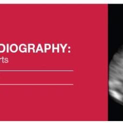 2016 Fetal Echocardiography: Normal and Abnormal Hearts – A Video CME Teaching Activity