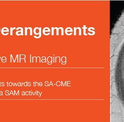 2016 Internal Derangements of Joints: Advanced and Intensive MR Imaging - A Video CME Teaching Activity