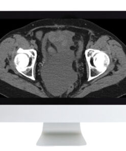 Radiologic Reasoning: A Rapid-Fire Multispecialty Review