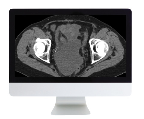 Radiologic Reasoning: A Rapid-Fire Multispecialty Review