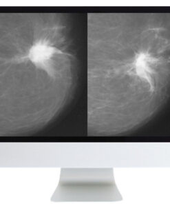 Harmonizing Breast Cancer Screening Recommendations Hybrid Course