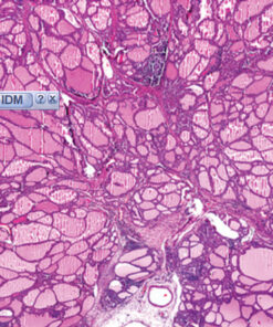 Head and Neck Pathology 2020