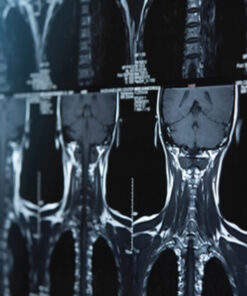 Neurosurgery – A Comprehensive Review 2021