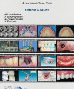 Introduction to Implant Prosthodontics: A Case-Based Clinical Guide Kallipos Open Academic Editions PDF Free download 