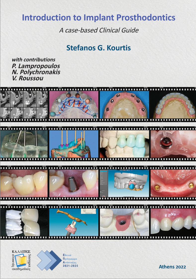 Introduction to Implant Prosthodontics: A Case-Based Clinical Guide Kallipos Open Academic Editions PDF Free download