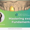 Mastering exocad Fundamentals  – iDD Mastering Exocad Bundle – Marjorie Andreade  