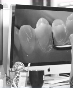 Bicuspid Veneer and V-Onlay Preparation