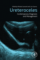 Ureteroceles Contemporary Diagnosis and Management 2020 Original pdf