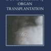 Bone Disease of Organ Transplantation 2005 Original pdf Bone Disease of Organ Transplantation 2005 Original pdf